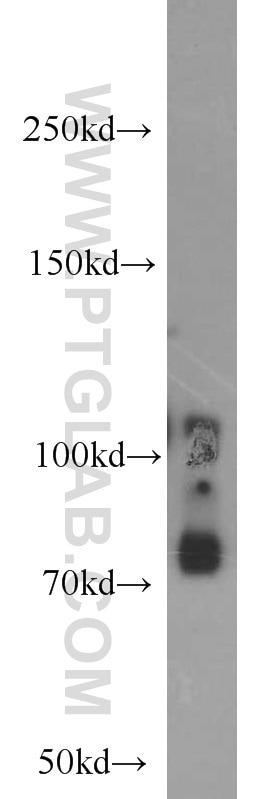 Western Blot (WB) analysis of mouse thymus tissue using CD84 Polyclonal antibody (12566-1-AP)