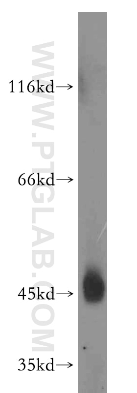 Western Blot (WB) analysis of mouse liver tissue using CD84 Polyclonal antibody (12566-1-AP)