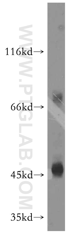Western Blot (WB) analysis of U-937 cells using CD84 Polyclonal antibody (12566-1-AP)