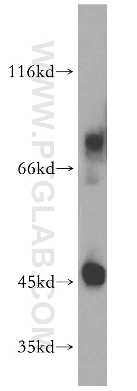 Western Blot (WB) analysis of mouse spleen tissue using CD84 Polyclonal antibody (12566-1-AP)