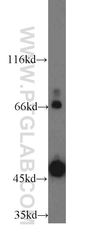Western Blot (WB) analysis of Raji cells using CD84 Polyclonal antibody (12566-1-AP)