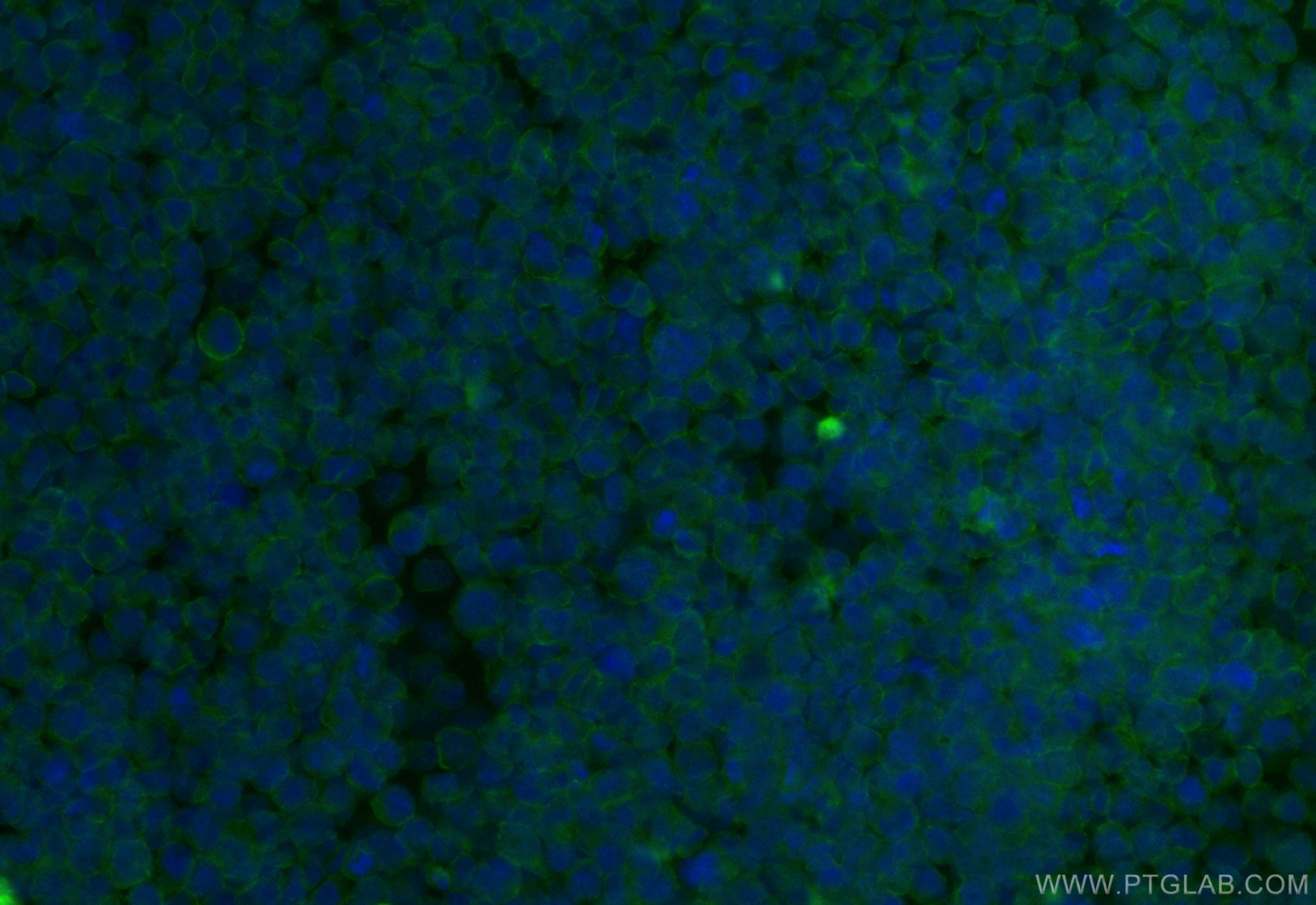 Immunofluorescence (IF) / fluorescent staining of raji cells using CoraLite® Plus 488-conjugated CD84 Recombinant ant (CL488-84245-2)