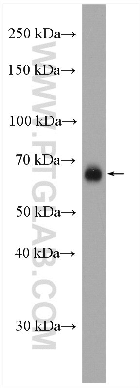 Western Blot (WB) analysis of Raji cells using CD86 Polyclonal antibody (13395-1-AP)