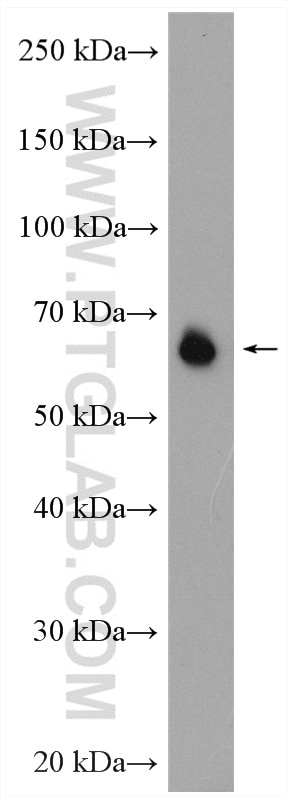 Western Blot (WB) analysis of Daudi cells using CD86 Polyclonal antibody (13395-1-AP)