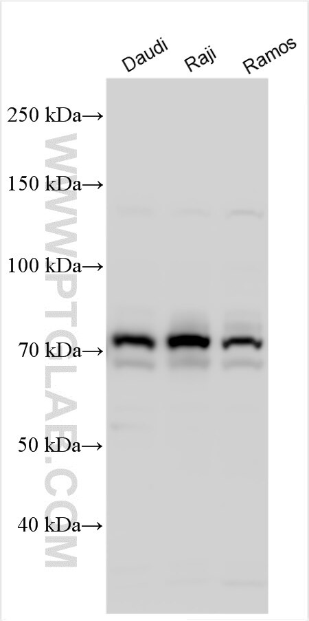 Western Blot (WB) analysis of various lysates using CD86 Polyclonal antibody (13395-1-AP)