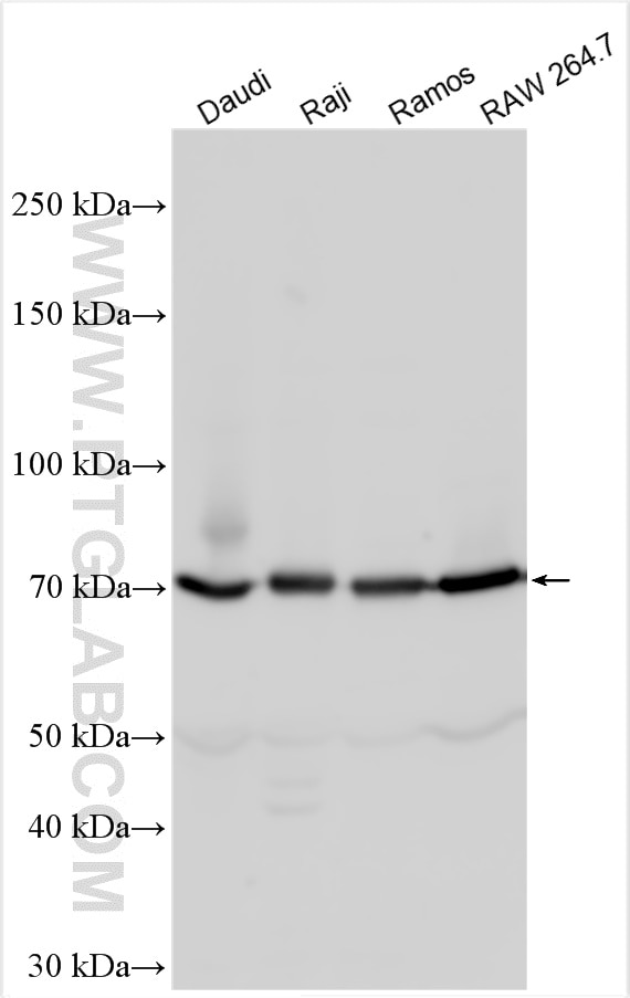 Western Blot (WB) analysis of various lysates using CD86 Polyclonal antibody (13395-1-AP)