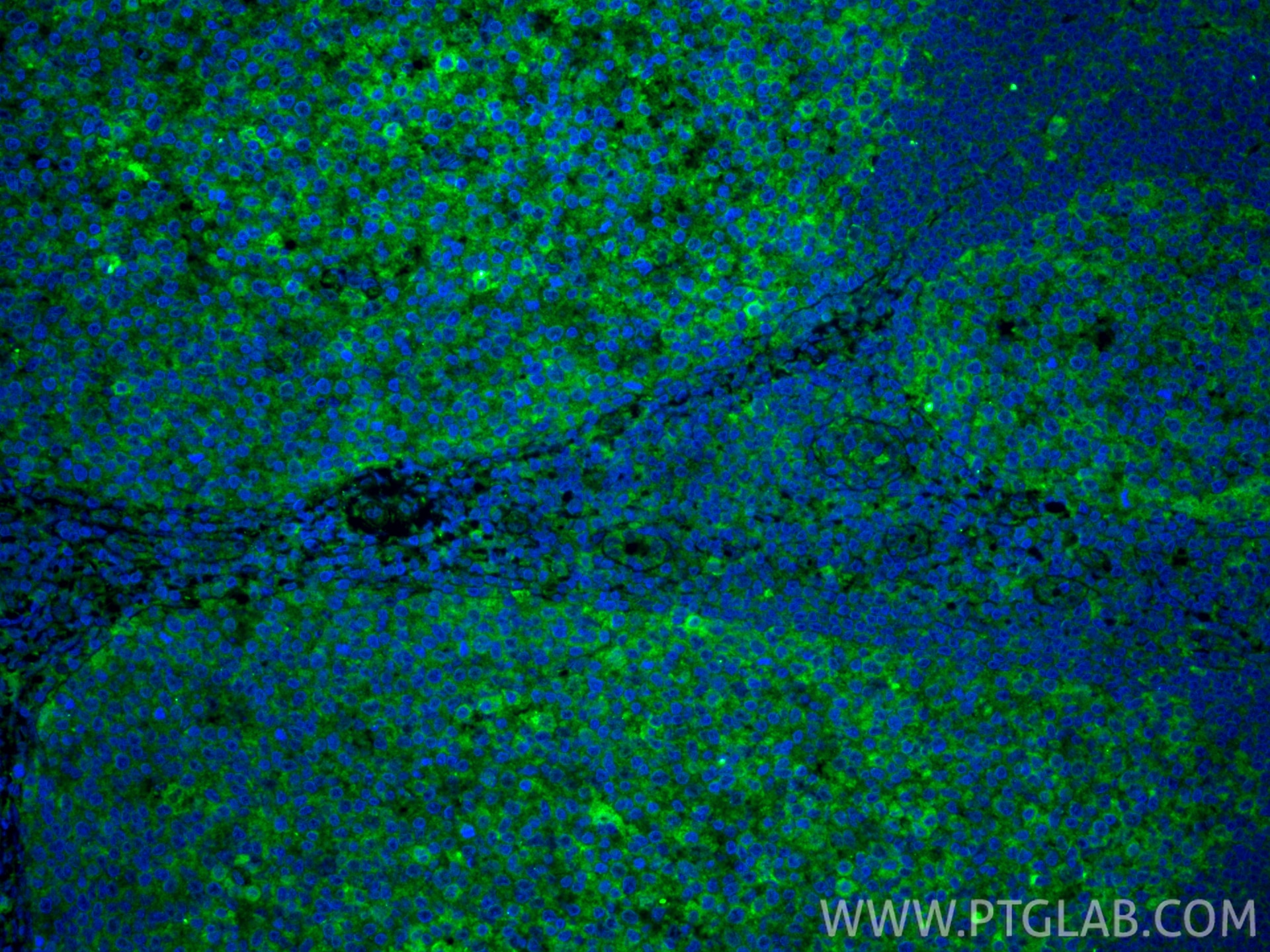 Immunofluorescence (IF) / fluorescent staining of human tonsillitis tissue using CD86 (C-terminal) Polyclonal antibody (26903-1-AP)