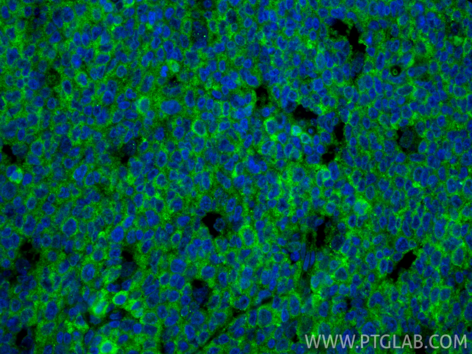 Immunofluorescence (IF) / fluorescent staining of human tonsillitis tissue using CD86 (C-terminal) Polyclonal antibody (26903-1-AP)