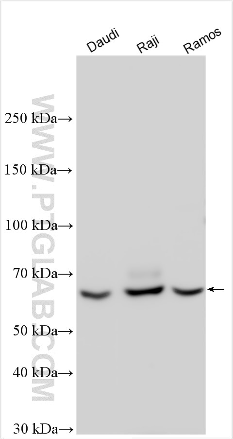 Western Blot (WB) analysis of various lysates using CD86 (C-terminal) Polyclonal antibody (26903-1-AP)