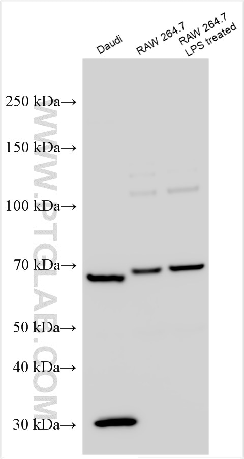 Western Blot (WB) analysis of various lysates using CD86 (C-terminal) Polyclonal antibody (26903-1-AP)