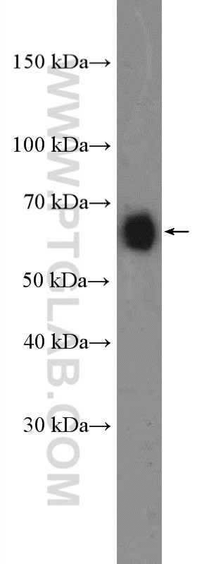 CD86 (C-terminal)