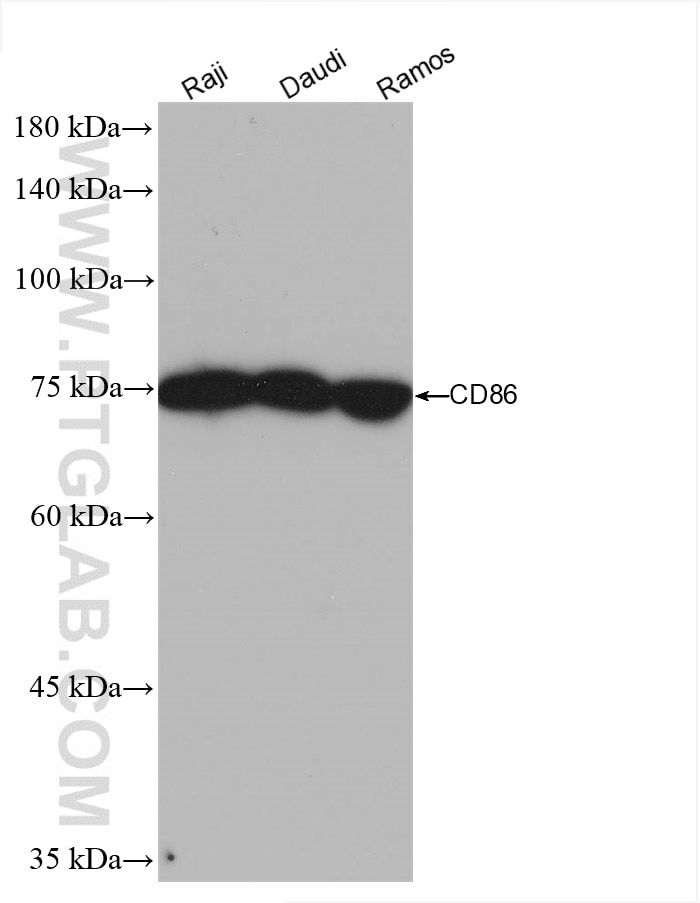 Western Blot (WB) analysis of various lysates using CD86 Recombinant antibody (82882-1-RR)