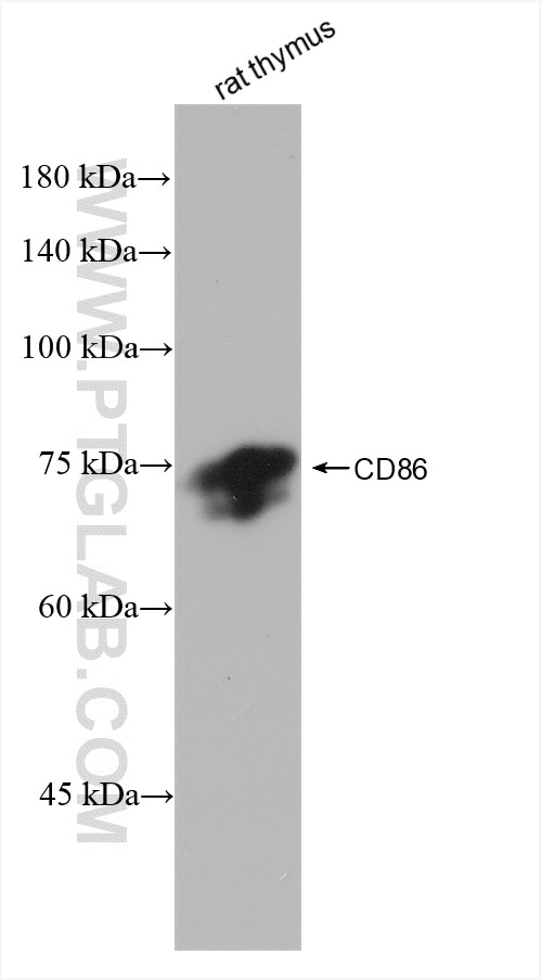 Western Blot (WB) analysis of rat thymus tissue using CD86 Recombinant antibody (82882-1-RR)