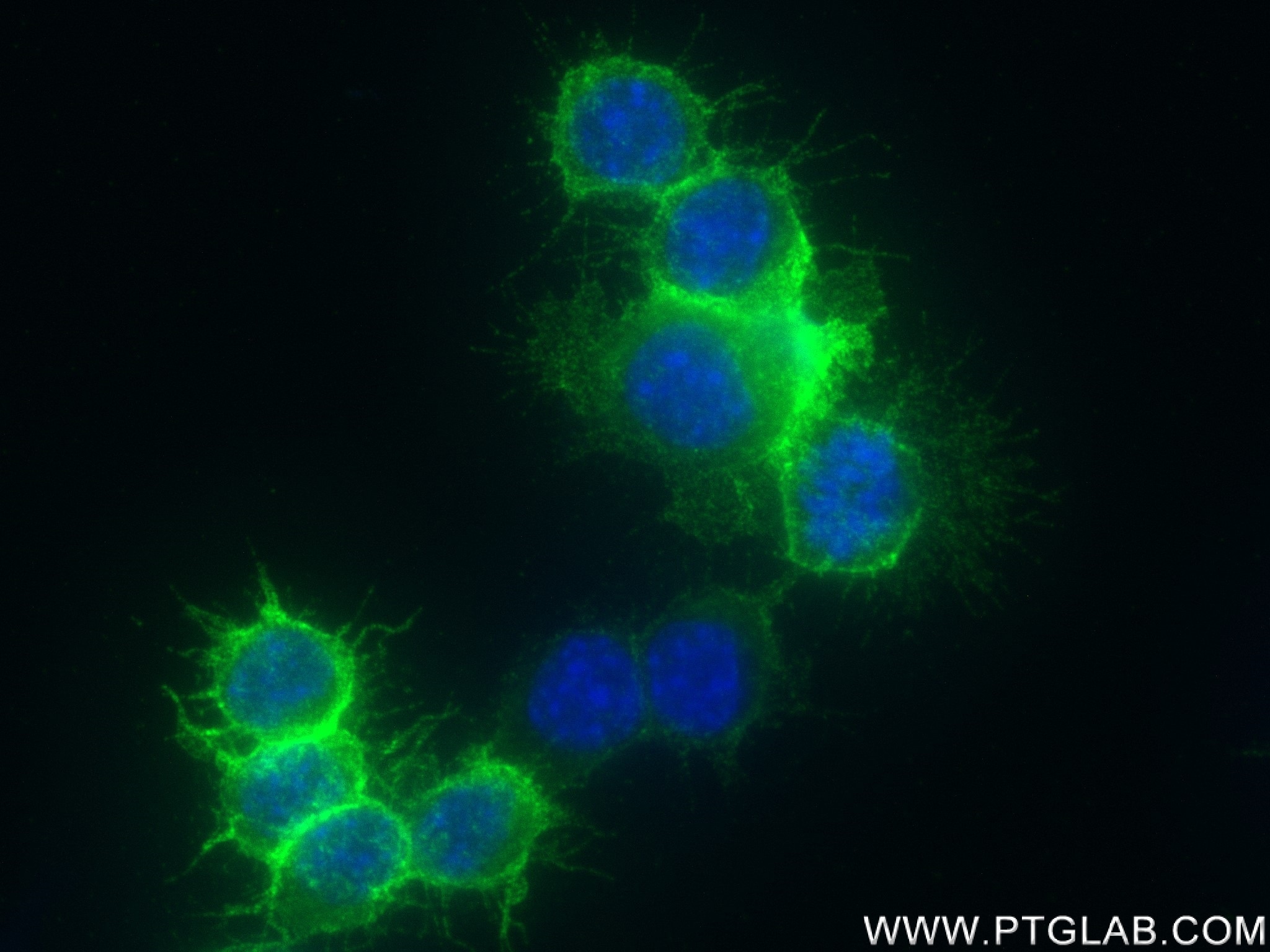 Immunofluorescence (IF) / fluorescent staining of RAW 264.7 cells using CD86 Recombinant antibody (83213-1-RR)