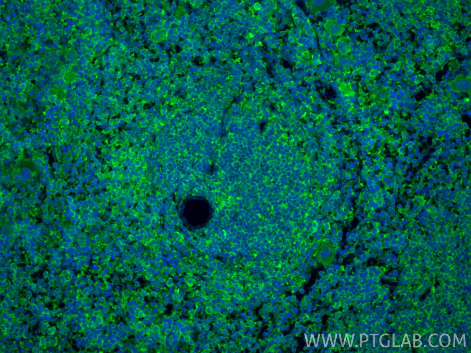 IF Staining of mouse spleen using 83213-1-RR Immunofluorescence (IF) / fluorescent staining of mouse spleen tissue using CD86 Recombinant monoclonal antibody (83213-1-RR)