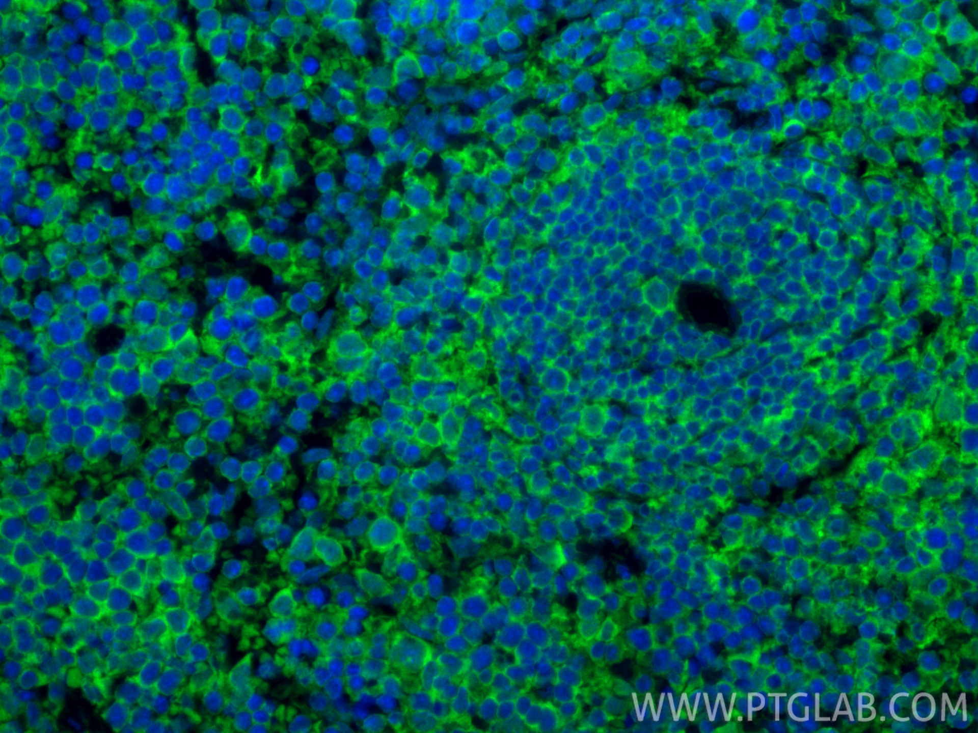 IF Staining of mouse spleen using 83213-1-RR Immunofluorescence (IF) / fluorescent staining of mouse spleen tissue using CD86 Recombinant monoclonal antibody (83213-1-RR)