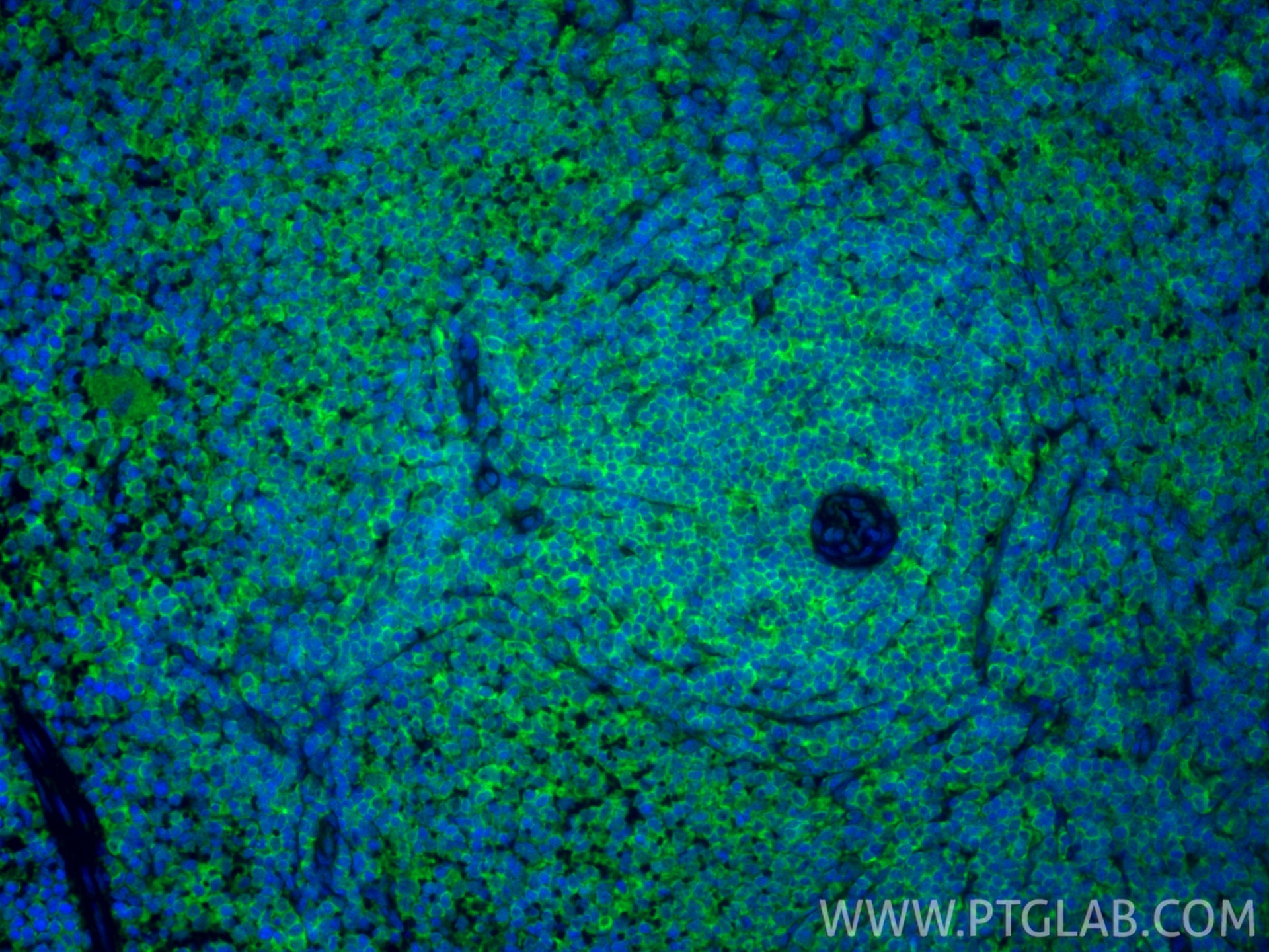 IF Staining of rat spleen using 83213-1-RR Immunofluorescence (IF) / fluorescent staining of rat spleen tissue using CD86 Recombinant monoclonal antibody (83213-1-RR)
