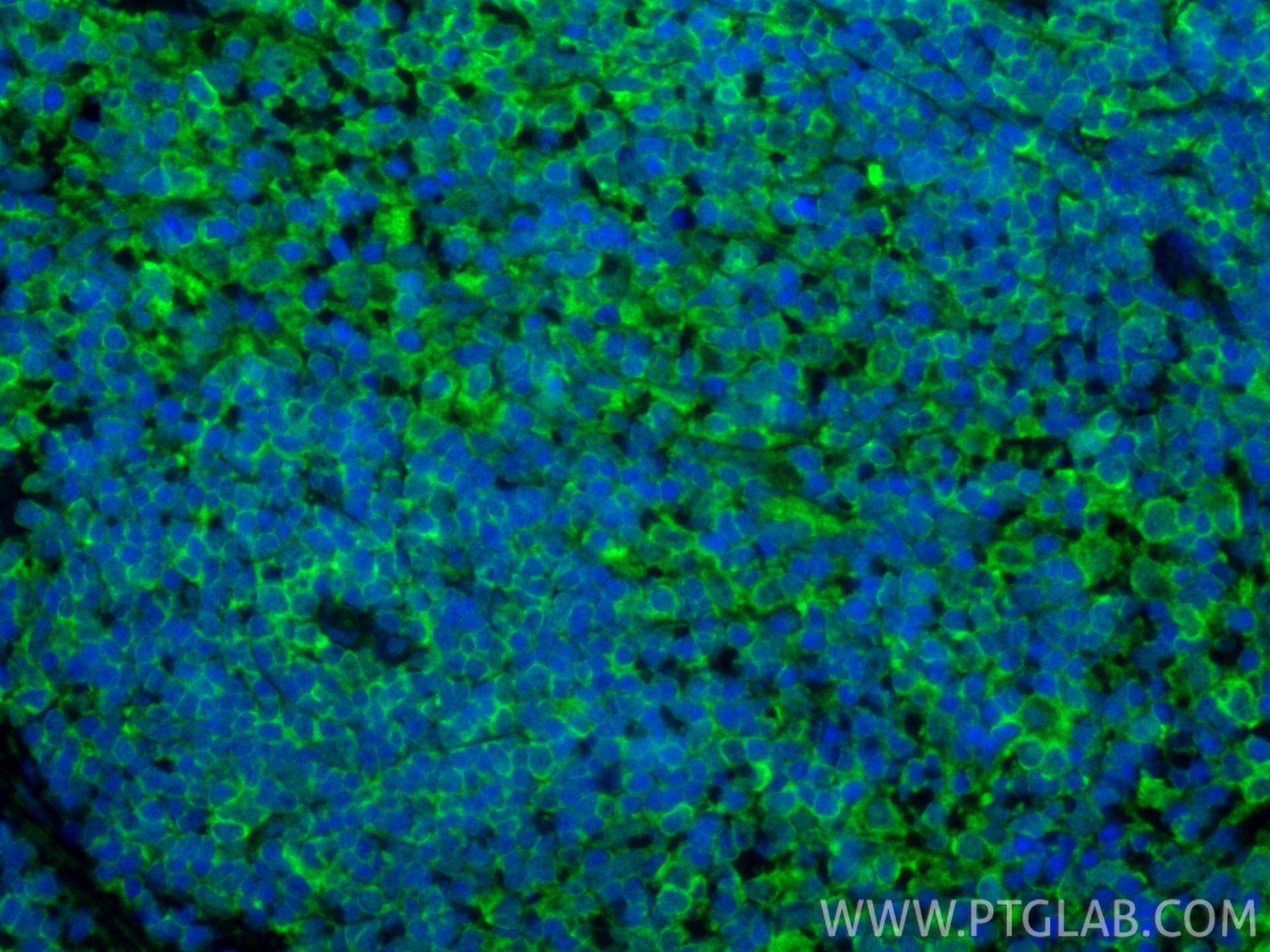 IF Staining of rat spleen using 83213-1-RR Immunofluorescence (IF) / fluorescent staining of rat spleen tissue using CD86 Recombinant monoclonal antibody (83213-1-RR)