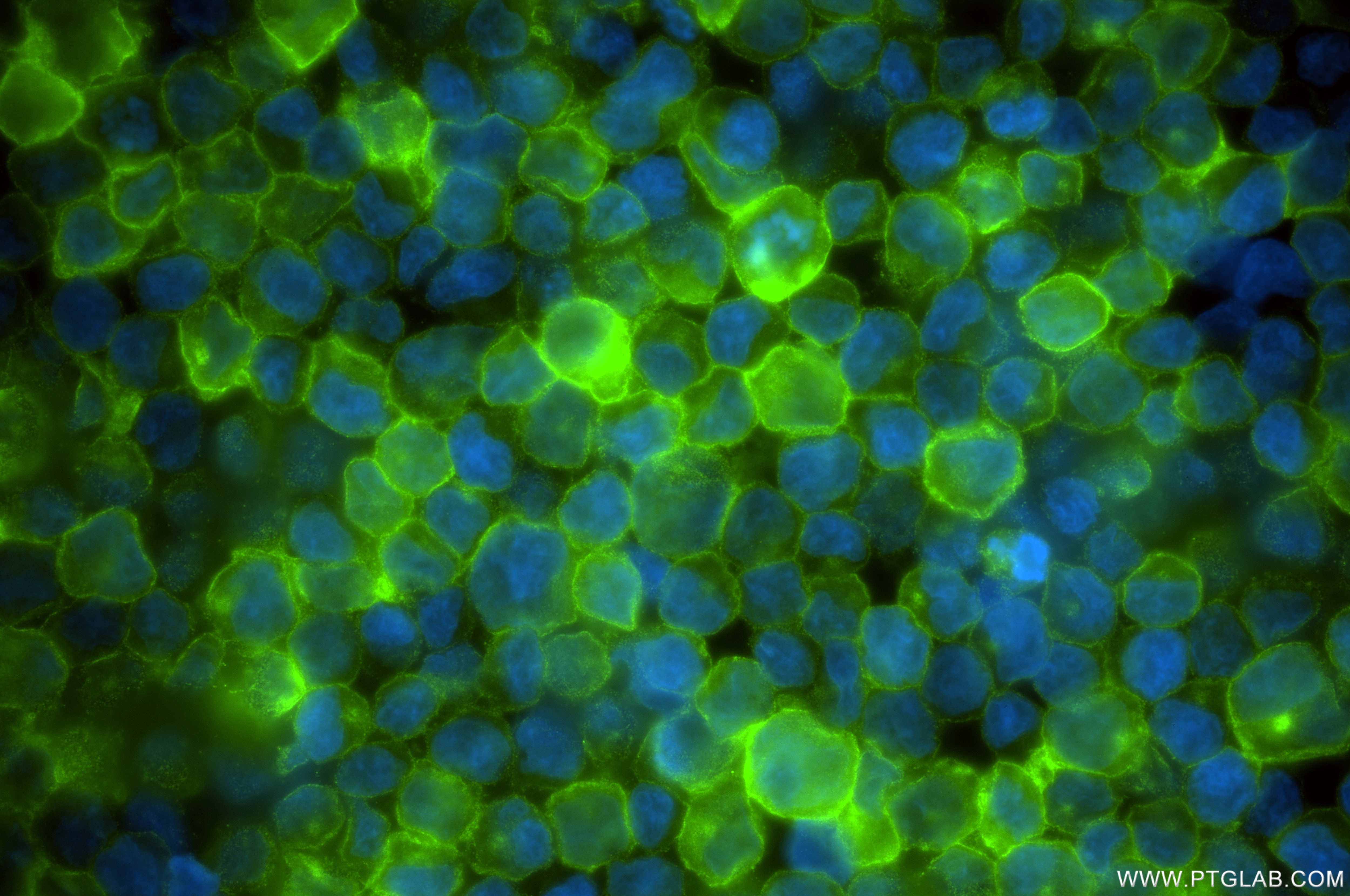 Immunofluorescence (IF) / fluorescent staining of Raji cells using CD86 Recombinant antibody (83523-4-RR)