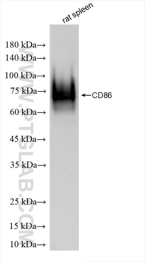 Western Blot (WB) analysis of rat spleen tissue using CD86 Recombinant antibody (86252-1-RR)