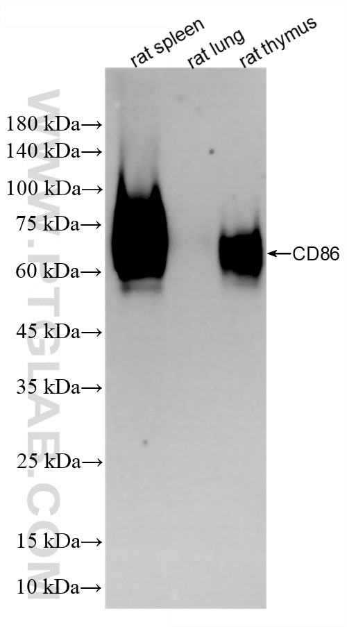 Western Blot (WB) analysis of various lysates using CD86 Recombinant monoclonal antibody (86252-1-RR)