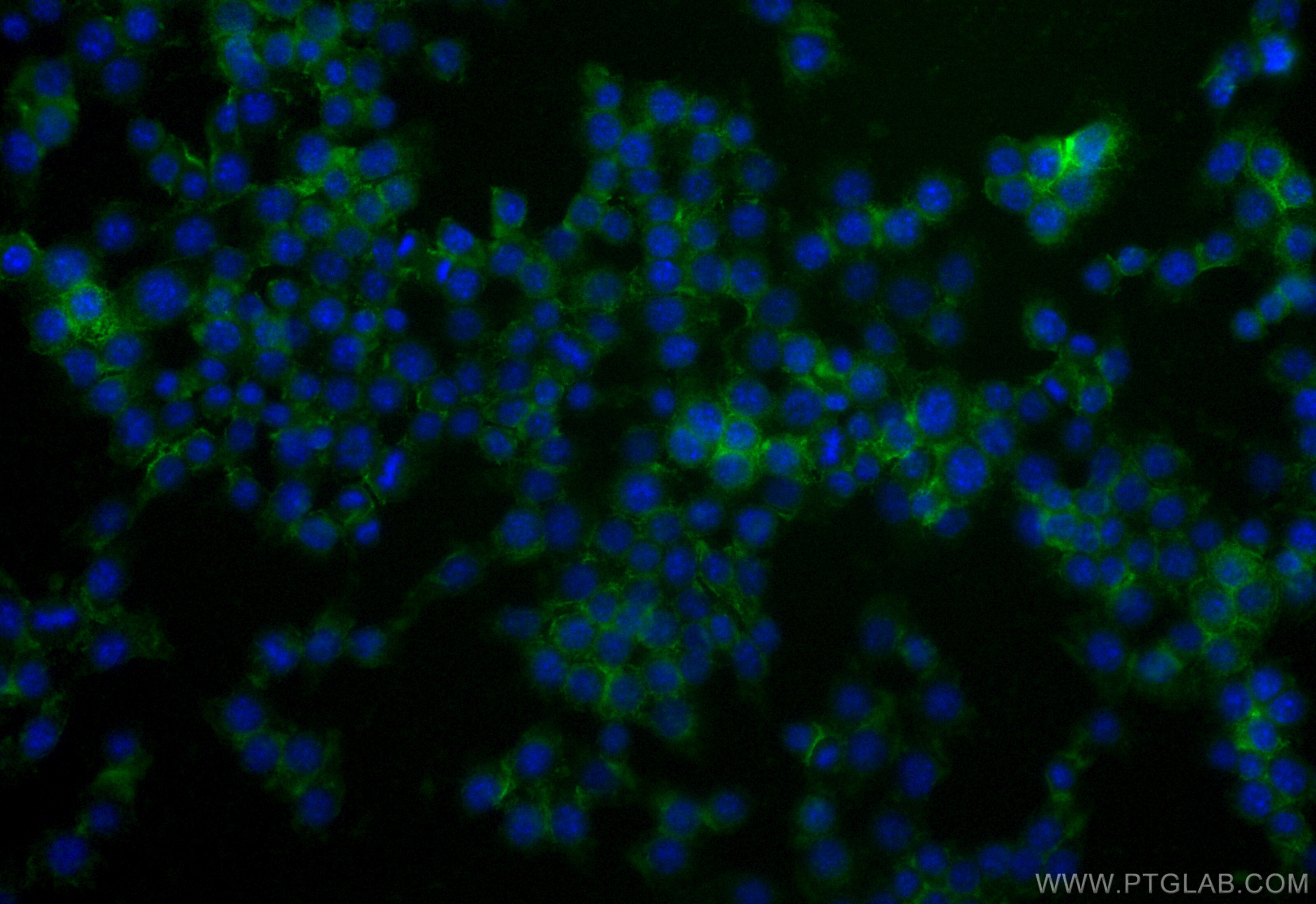 Immunofluorescence (IF) / fluorescent staining of RAW 264.7 cells using CoraLite® Plus 488 Anti-Mouse CD86 Rabbit Recombin (CL488-98025)