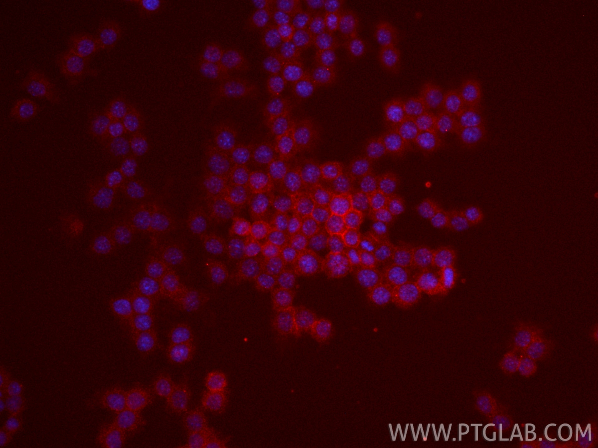 Immunofluorescence (IF) / fluorescent staining of RAW 264.7 cells using CoraLite®594-conjugated CD86 Recombinant monoclona (CL594-83213)