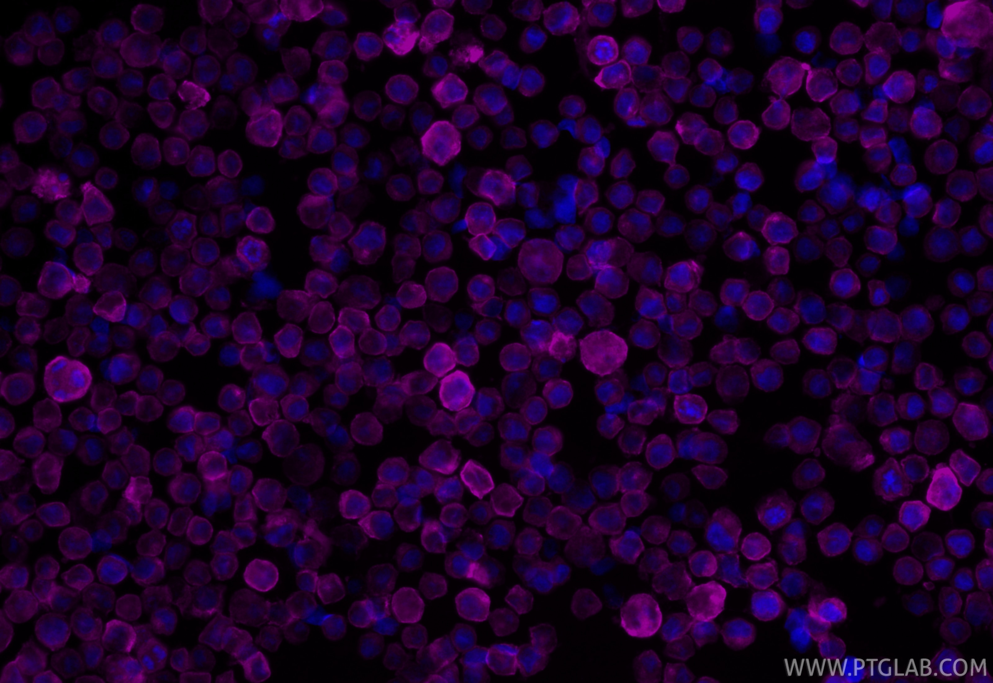 Immunofluorescence (IF) / fluorescent staining of Raji cells using CoraLite® Plus 647-conjugated CD86 Recombinant mon (CL647-83523-4)