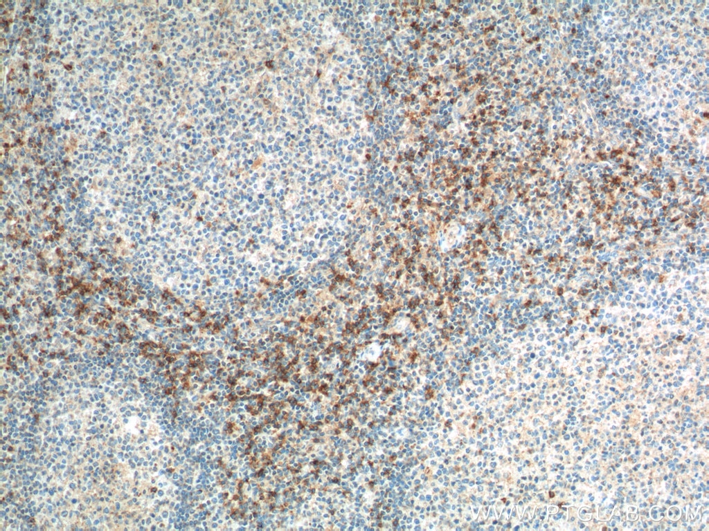 CD8a Polyclonal antibody