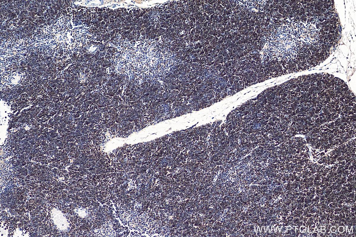 Immunohistochemistry (IHC) staining of mouse thymus tissue using CD8a Polyclonal antibody (29896-1-AP)