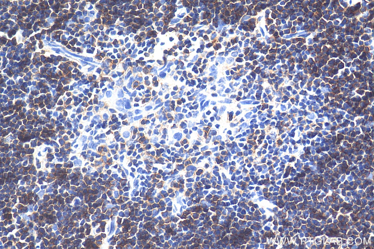 Immunohistochemistry (IHC) staining of mouse thymus tissue using CD8a Polyclonal antibody (29896-1-AP)