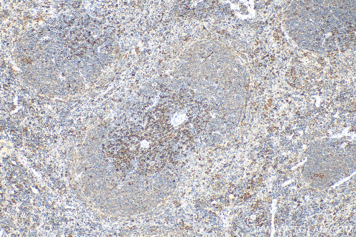 Immunohistochemistry (IHC) staining of mouse spleen tissue using CD8a Polyclonal antibody (29896-1-AP)