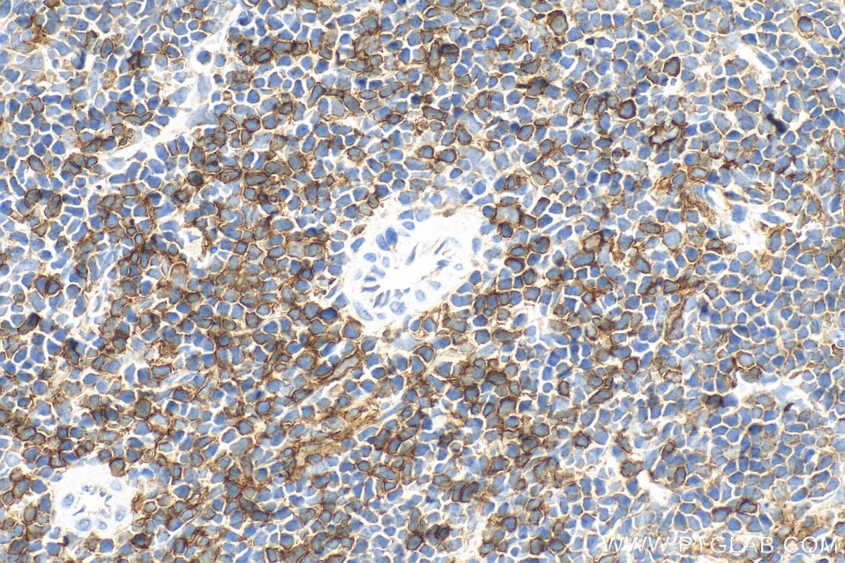 Immunohistochemistry (IHC) staining of mouse spleen tissue using CD8a Polyclonal antibody (29896-1-AP)