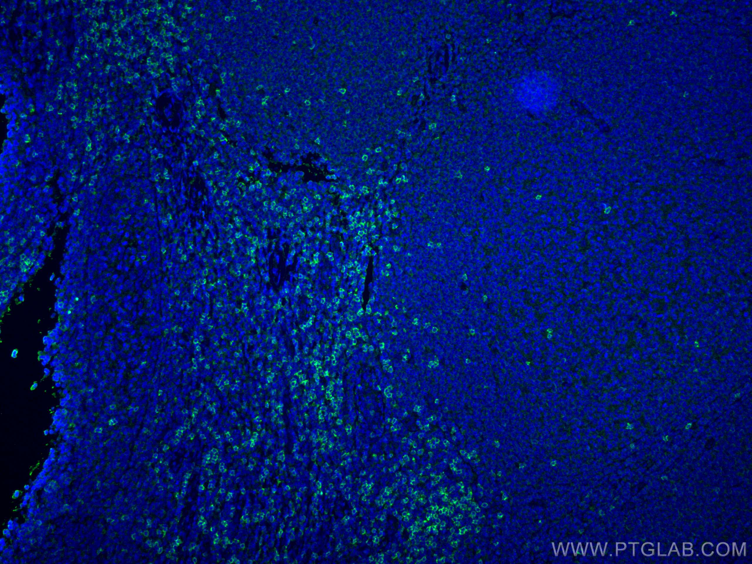 Immunofluorescence (IF) / fluorescent staining of human tonsillitis tissue using CD8a Monoclonal antibody (66868-1-Ig)