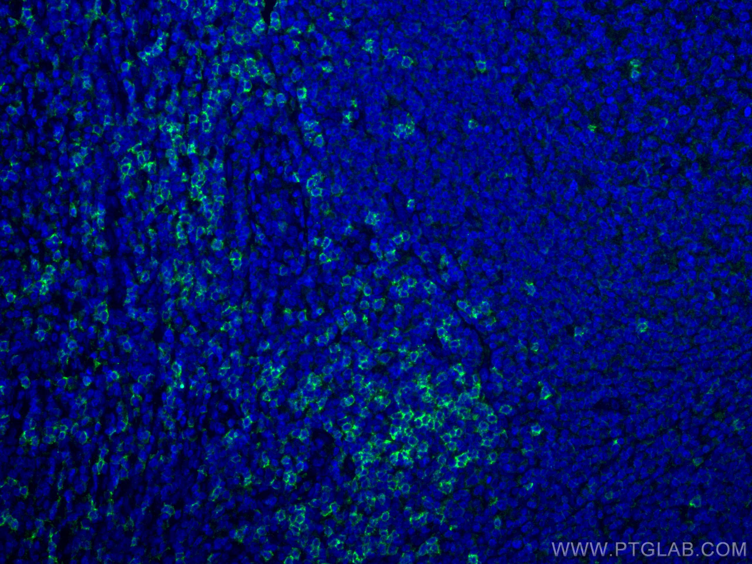 Immunofluorescence (IF) / fluorescent staining of human tonsillitis tissue using CD8a Monoclonal antibody (66868-1-Ig)