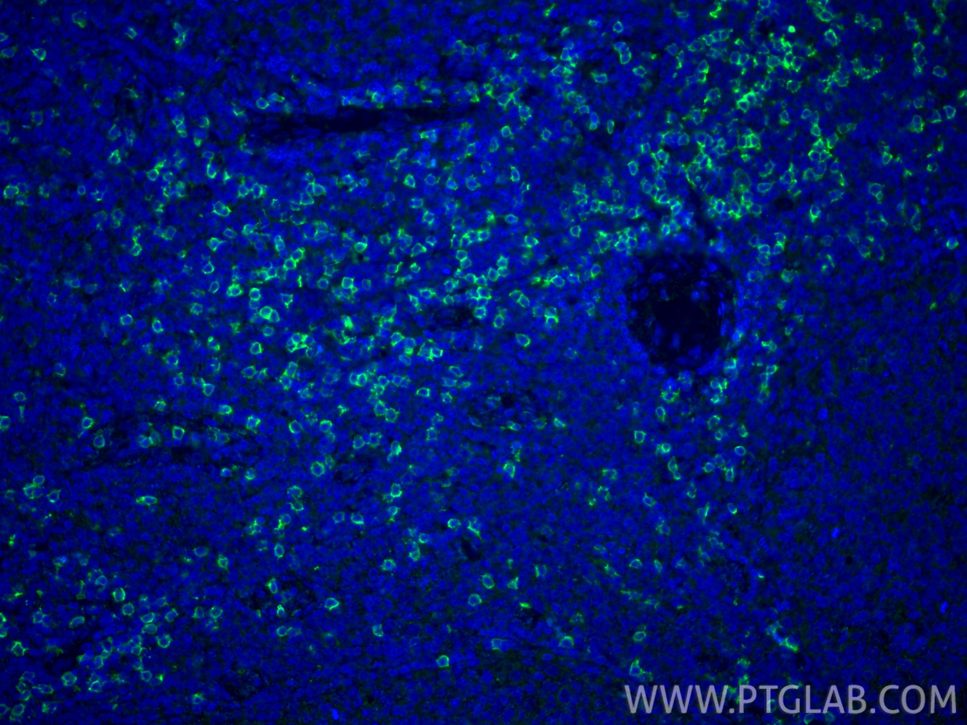 Immunofluorescence (IF) / fluorescent staining of human tonsillitis tissue using CD8a Monoclonal antibody (66868-1-Ig)