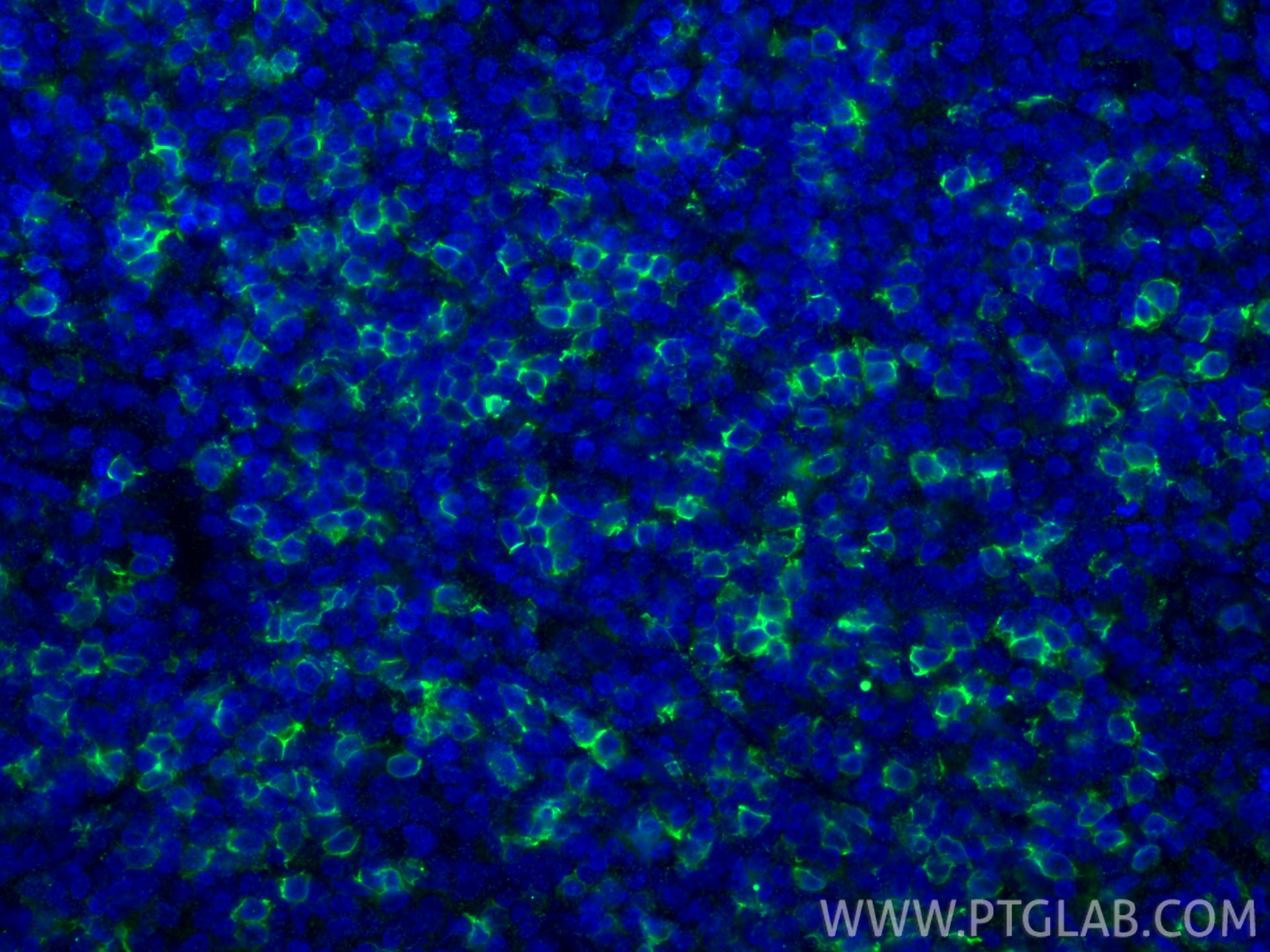 Immunofluorescence (IF) / fluorescent staining of human tonsillitis tissue using CD8a Monoclonal antibody (66868-1-Ig)
