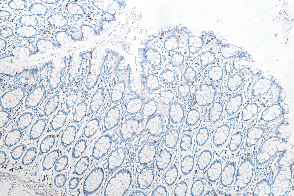 IHC staining of human colon using 66868-1-Ig Immunohistochemistry (IHC) staining of human colon tissue using CD8a Monoclonal antibody (66868-1-Ig)