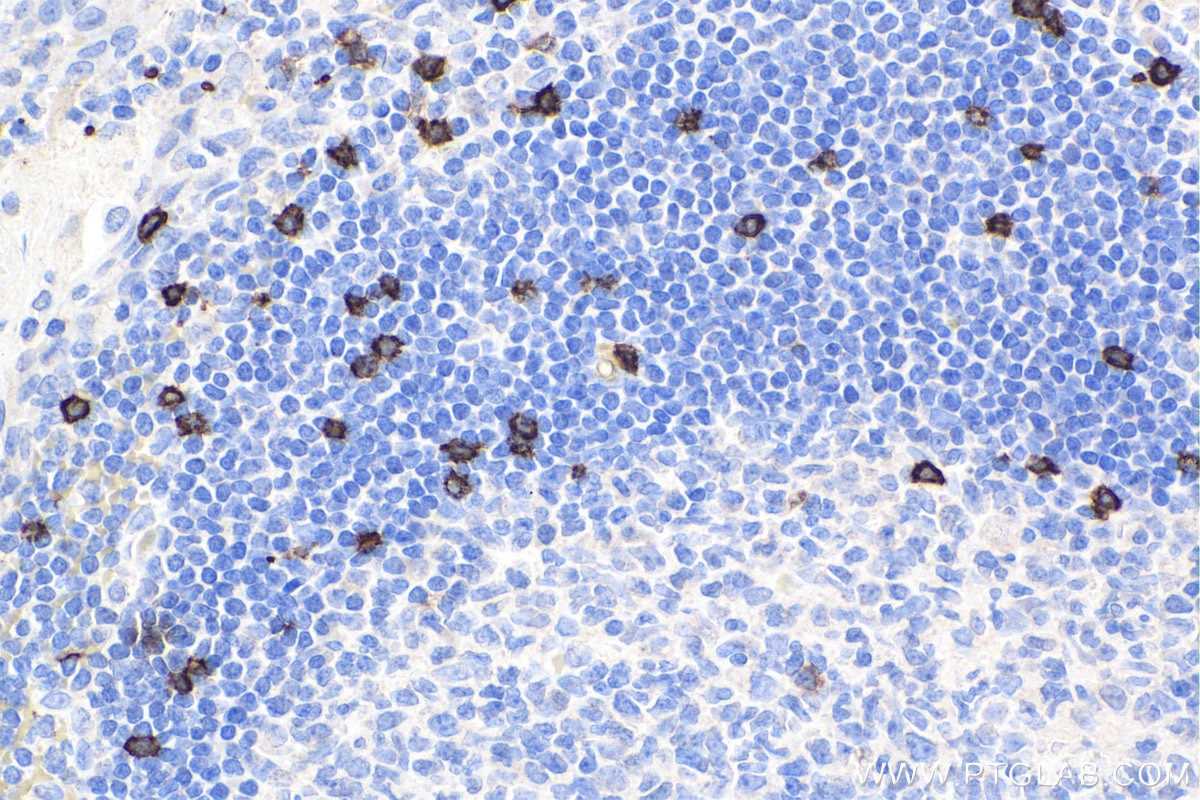 Immunohistochemistry (IHC) staining of human tonsillitis tissue using CD8a Monoclonal antibody (66868-1-Ig)