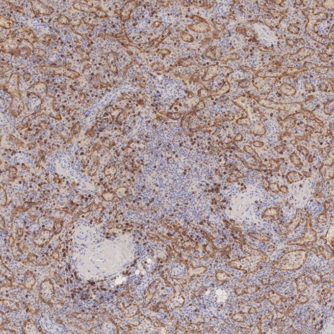 Immunohistochemistry (IHC) staining of human spleen tissue using CD8a Monoclonal antibody (66868-1-Ig)