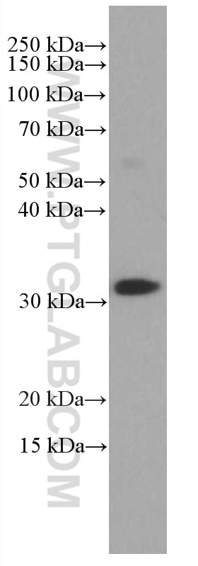 Western Blot (WB) analysis of human peripheral blood leukocyte using CD8 Monoclonal antibody (66868-1-Ig)