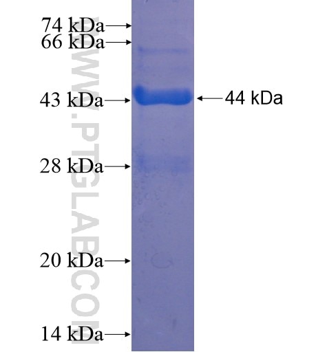 CD8A fusion protein Ag11370 SDS-PAGE