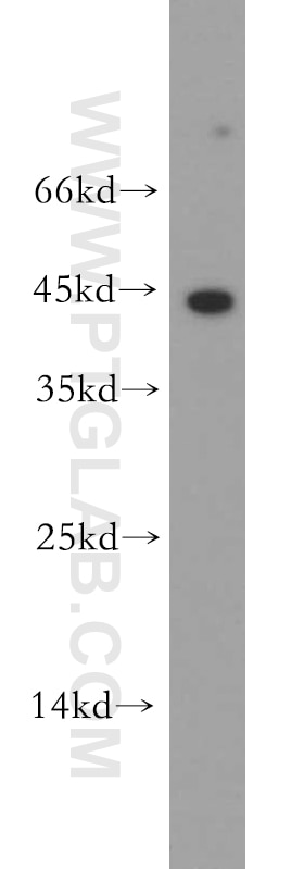 CD8 Polyclonal antibody