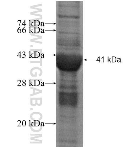 CD8B fusion protein Ag15805 SDS-PAGE