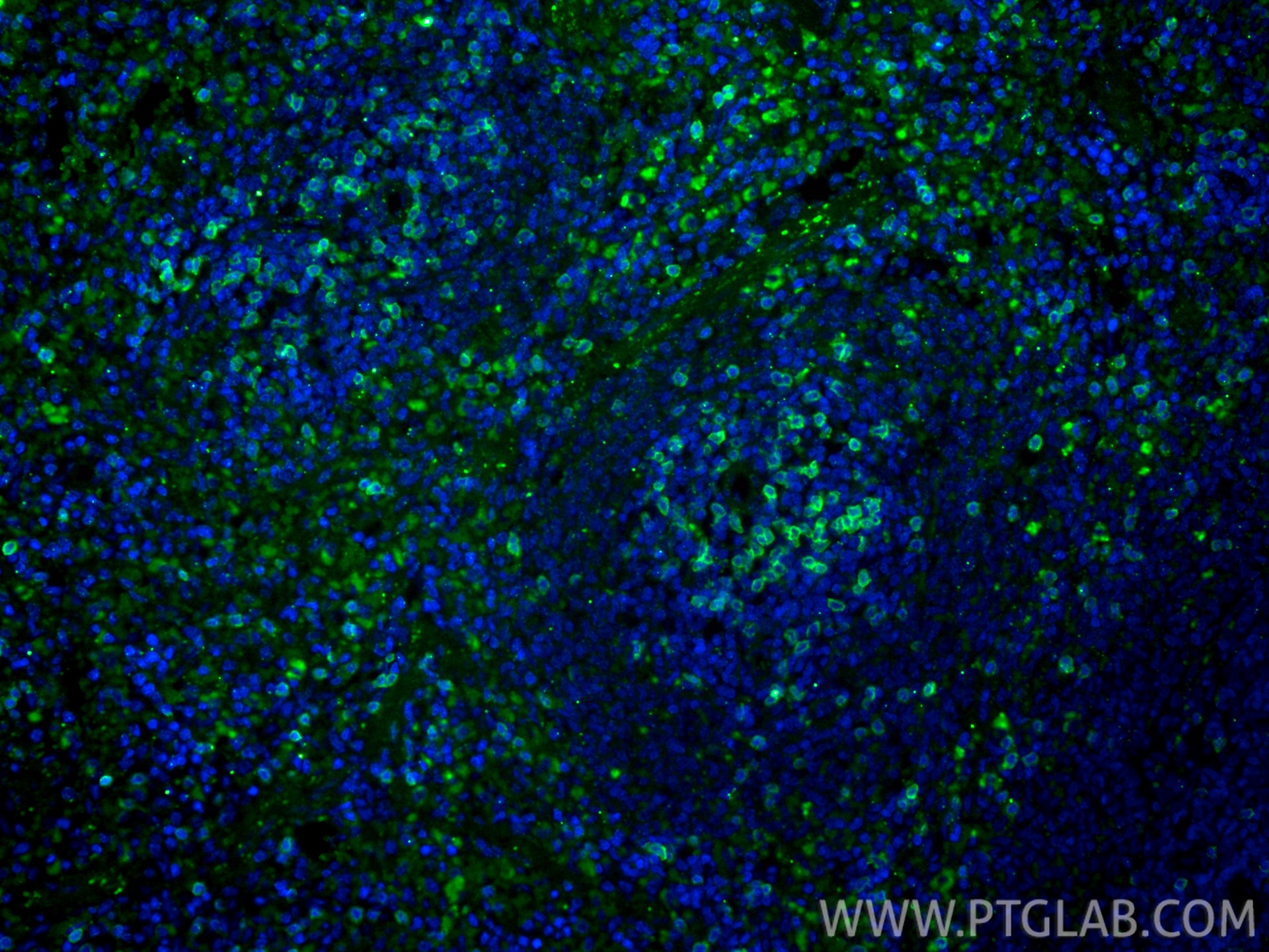 Immunofluorescence (IF) / fluorescent staining of rat spleen tissue using CD8a Polyclonal antibody (33186-1-AP)