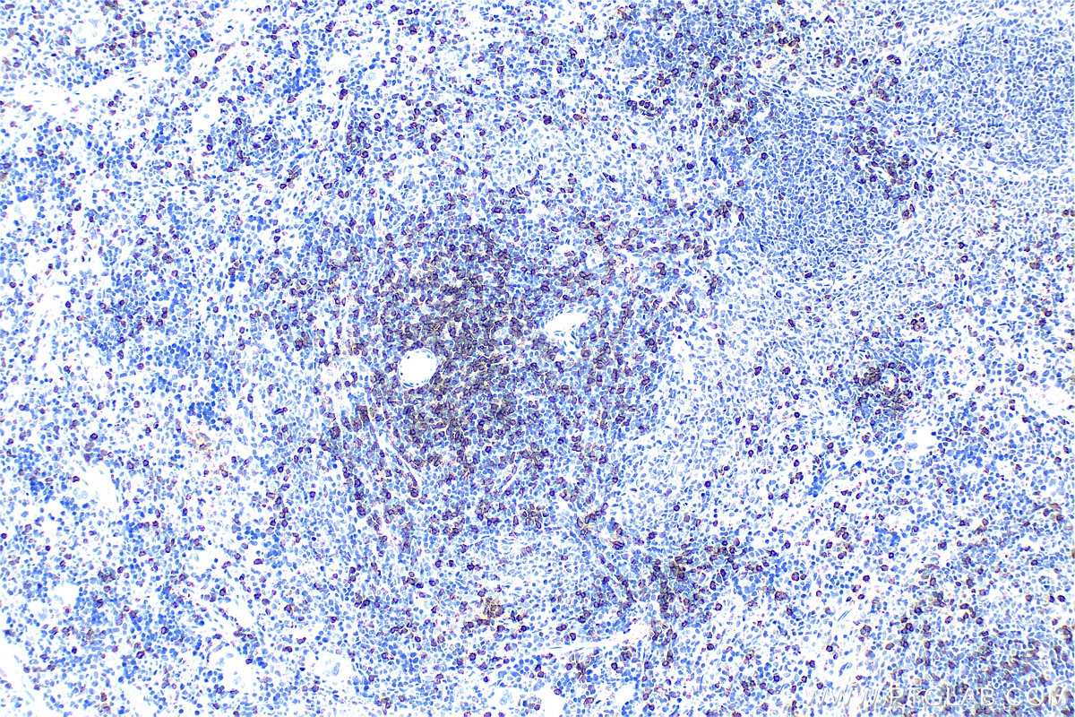 Immunohistochemistry (IHC) staining of rat spleen tissue using CD8a Polyclonal antibody (33186-1-AP)