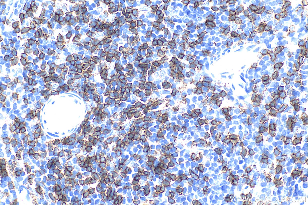 Immunohistochemistry (IHC) staining of rat spleen tissue using CD8a Polyclonal antibody (33186-1-AP)