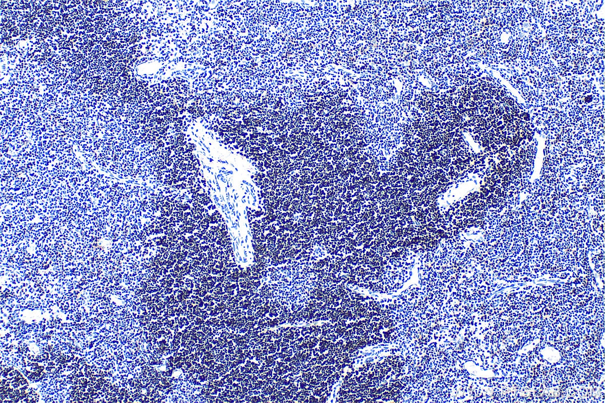 Immunohistochemistry (IHC) staining of rat thymus tissue using CD8a Polyclonal antibody (33186-1-AP)