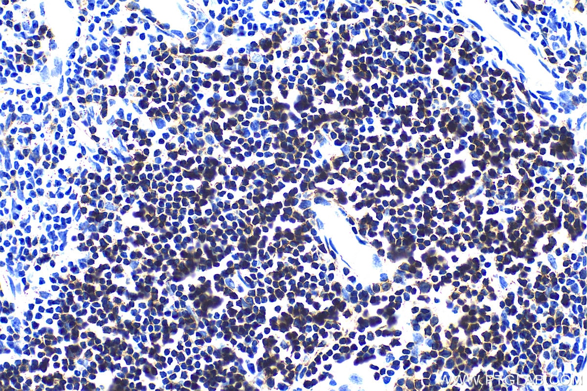 Immunohistochemistry (IHC) staining of rat thymus tissue using CD8a Polyclonal antibody (33186-1-AP)
