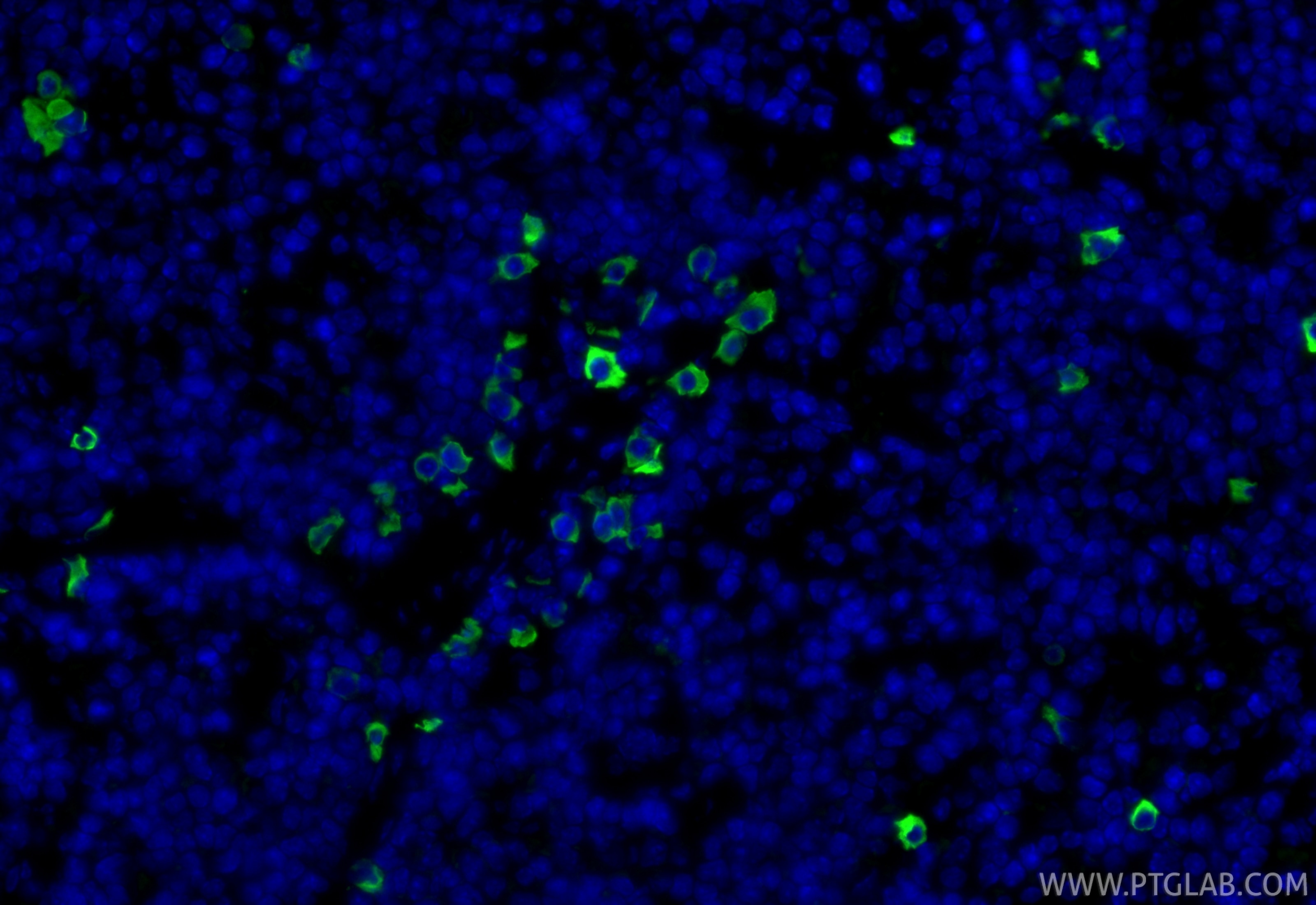 Immunofluorescence (IF) / fluorescent staining of mouse spleen tissue using Anti-Mouse CD8a (5H10-1) (65205-1-Ig)